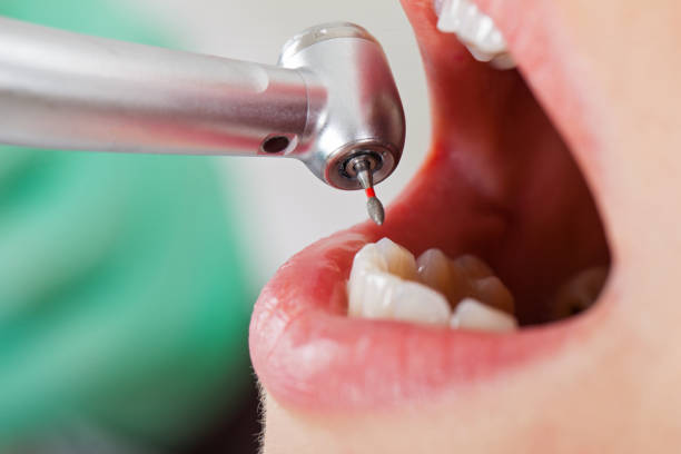 Best Emergency Dentist for Knocked-Out Tooth in Barclay, NJ